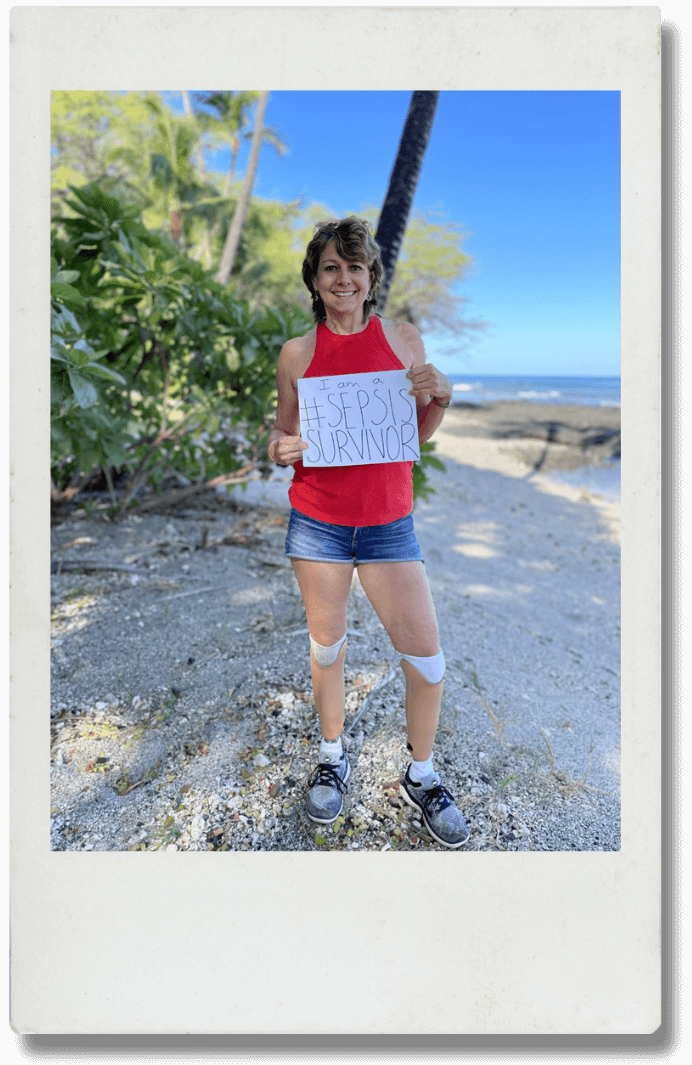 Sepsis Survivor